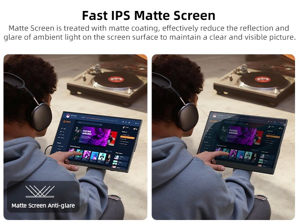 UPERFECT 2026 15.6″ Touchscreen Portable Monitor 1080P For Xbox PS Gaming Switch